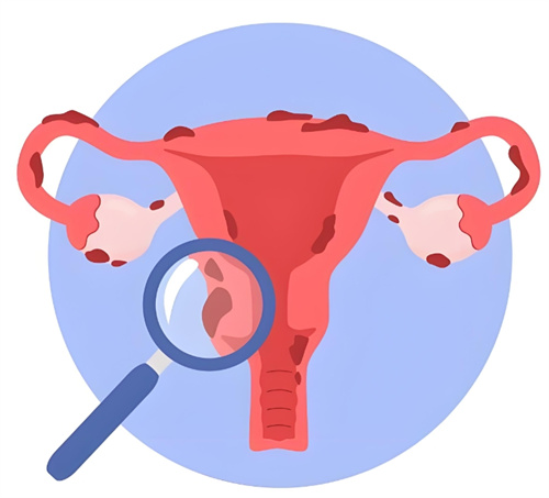 女性如果子宫有异常病变，会有六类相关信号的释放！