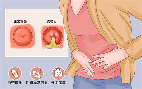 女性如果子宫有异常病变，会有六类相关信号的释放！
