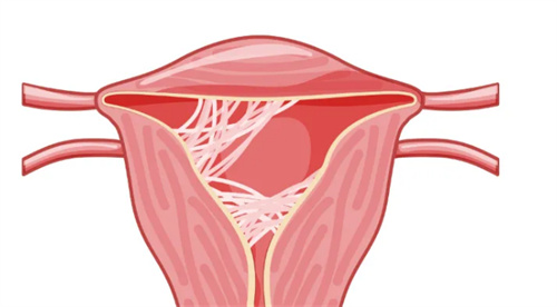 女性如果子宫有异常病变，会有六类相关信号的释放！