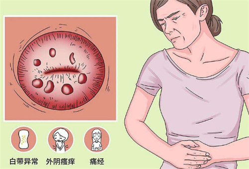 宫颈是女性生育的入口，如果发生异常病变会有三大信号的提示！