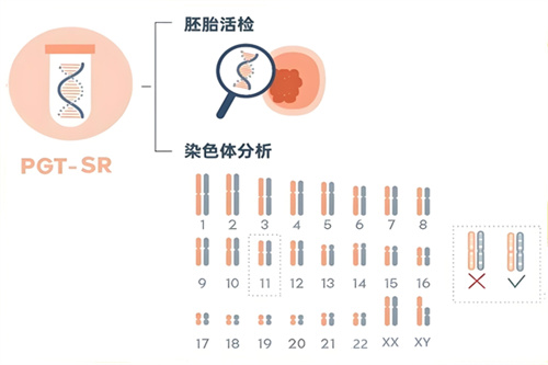 揭示胎儿抵御感染机制，第三代试管打开健康妊娠新视角！