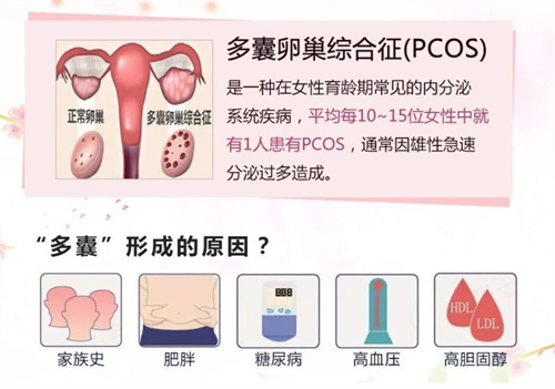 警惕多囊可能会反应在女性的脸上，痤疮蔓延要及时就医！