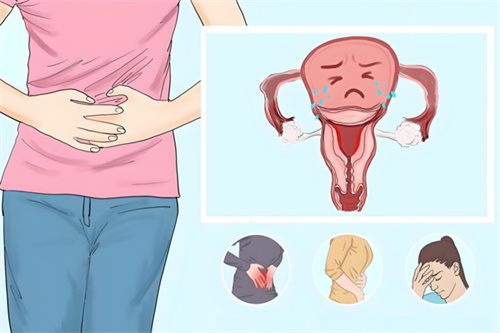 热搜！痛经女性近半或为子宫内膜异位症？