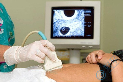 热搜！痛经女性近半或为子宫内膜异位症？