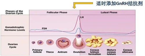 做试管婴儿：什么时间打破卵针，有什么需要注意的？