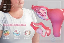 多囊卵差易流产原因找到啦！文献证实都是它在捣乱，早知道早受益