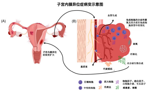 近28万人数据：Ta堪称「生育力第一杀手」，5步治疗终身获益！