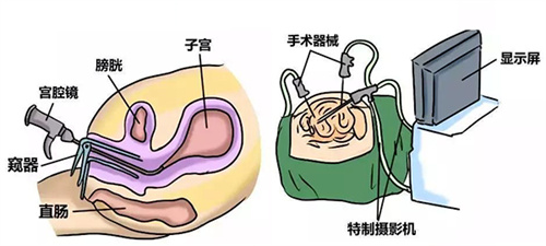 AMH低？做好这5点，也能快速抱娃！