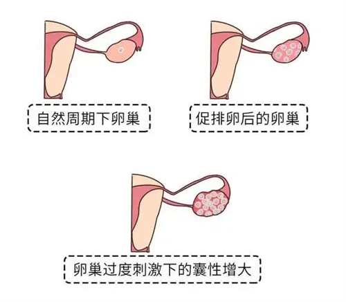 鲜胚和冻胚，谁才是「胚胎王者」？