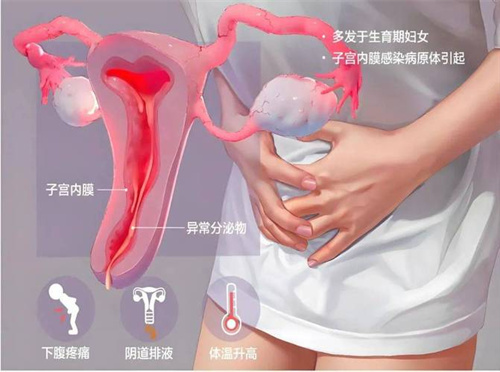 患有阴道炎会影响囊胚着床吗？做试管婴儿的解决之道