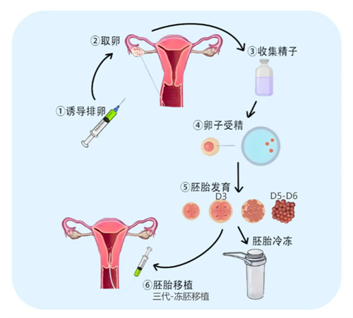被传为有“恶魔基因”的超雄综合征能被试管PGT技术排除吗？