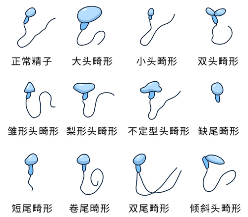 被误解的"不孕"真相：男性因素如何成为好孕路上的隐形关卡？
