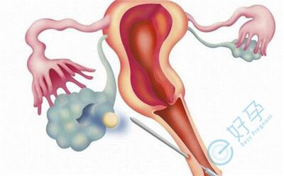 试管婴儿全流程关键注意事项：从术前到术后，科学应对指南