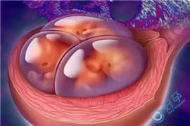 排卵障碍都是“作”出来的，看看你中了几个？