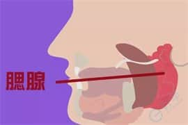 腮腺炎会导致精子质量变差吗，泰国试管如何解决?