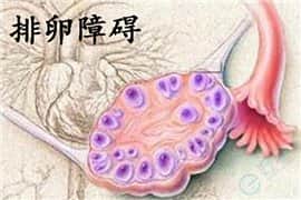 遇上排卵障碍？做试管婴儿能不能顺利好孕？