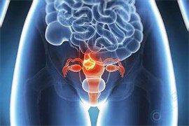 宫颈病变可能导致不孕、流产、早产，做试管婴儿的成功率有多少？
