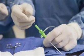 试管婴儿取卵全攻略：术前到术后2大关键点全解析