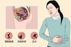 输卵管囊肿对试管婴儿周期有影响吗？
