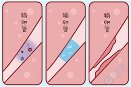 输卵管积水不做处理就做试管？这4件事没搞明白，胚胎可能白移植了