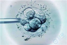 取卵不少但胚胎碎片多？从卵子到精子，这3个方向帮你找出"罪魁祸首"