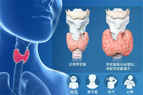 这个胎停二号杀手,比「免疫」问题还普遍!90%的人却都忽略了!