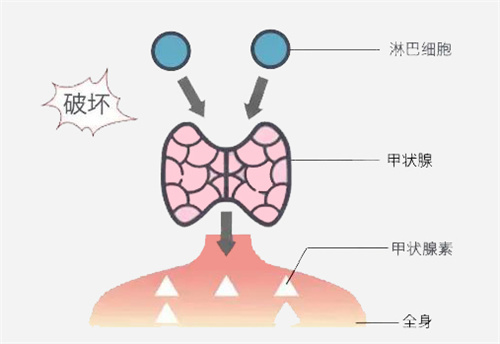 AMH低、卵子差就打生长激素?很多人第一步就错了!6个隐形卡点别忽视